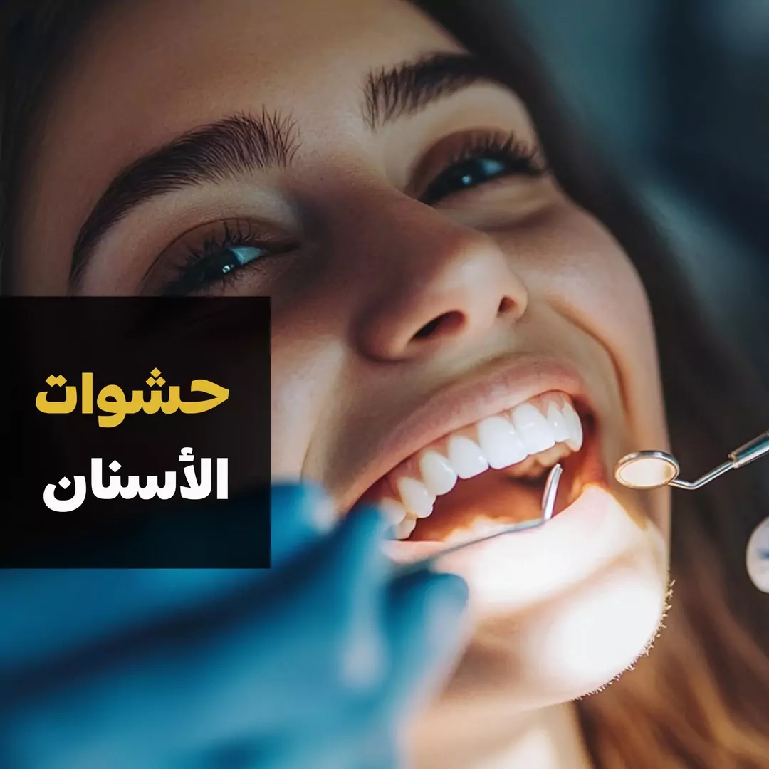 ابتكارات مذهلة في حشوات الأسنان التجميلية: اكتشف كيف نحسن ابتسامتك